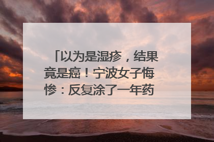 以为是湿疹，结果竟是癌！宁波女子悔惨：反复涂了一年药膏都没好！很多患者首诊都去了皮肤科