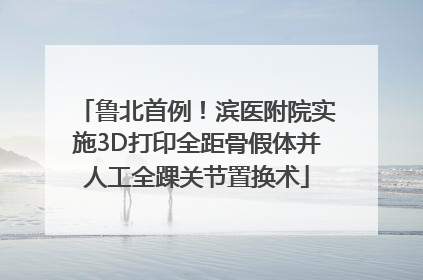 鲁北首例！滨医附院实施3D打印全距骨假体并人工全踝关节置换术